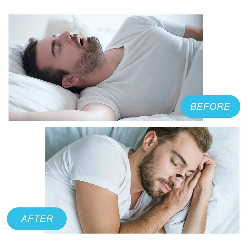 50% OFF Magnetic Nasal Strips