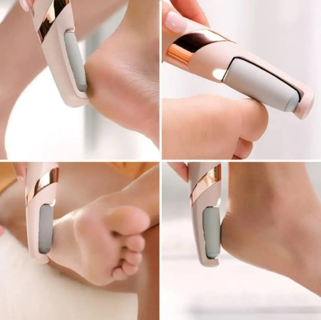 Electric Foot Callus Remover – Pedicure File for Cracked Heels