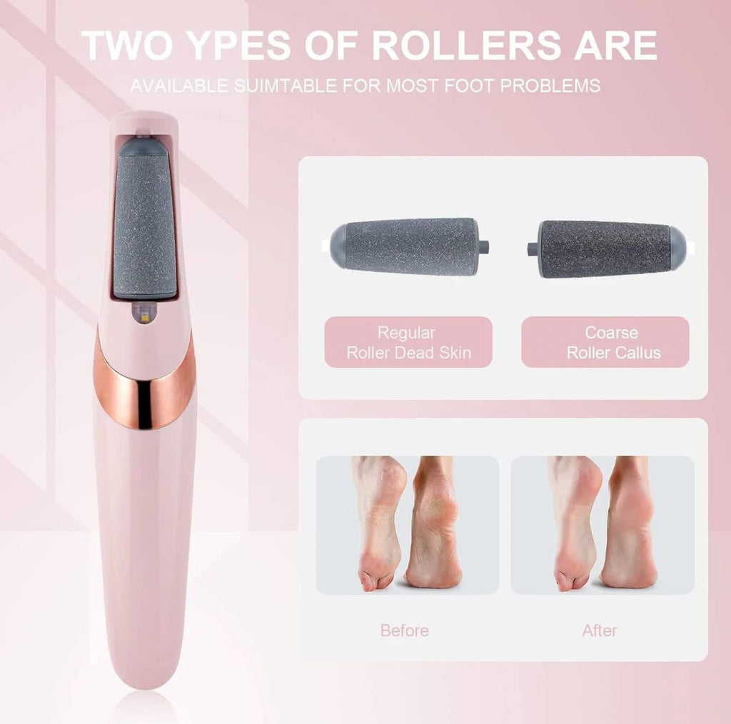 Electric Foot Callus Remover – Pedicure File for Cracked Heels