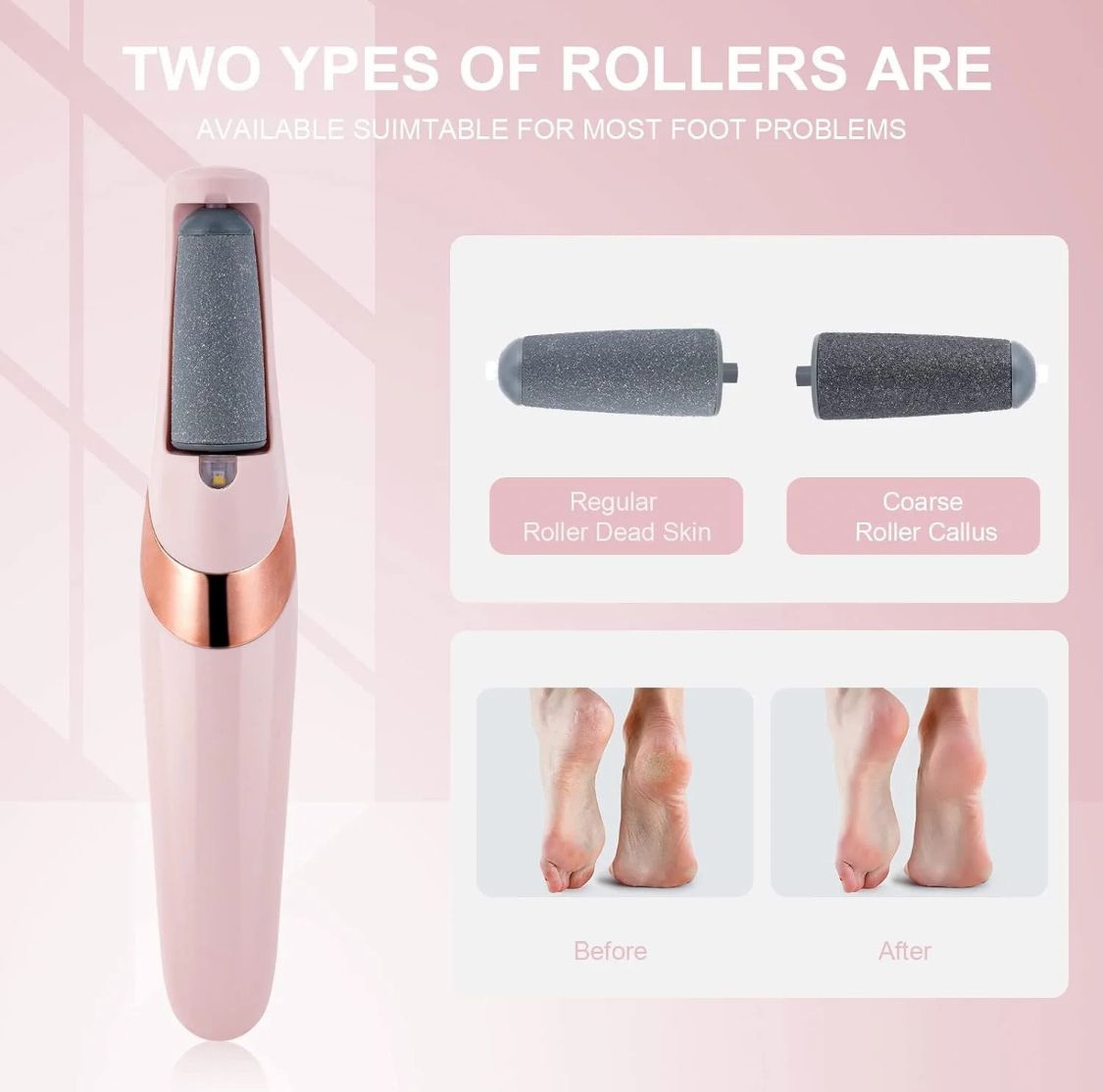 Electric Foot Callus Remover – Pedicure File for Cracked Heels