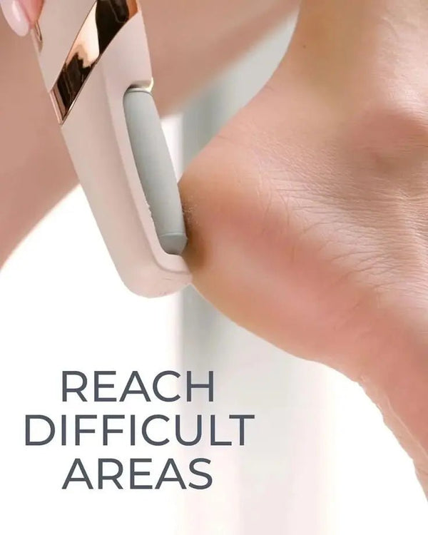 Electric Foot Callus Remover – Pedicure File for Cracked Heels